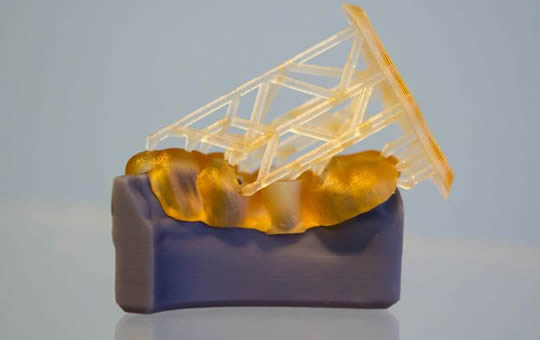 Human jaw printed on 3D printer of photopolymer.