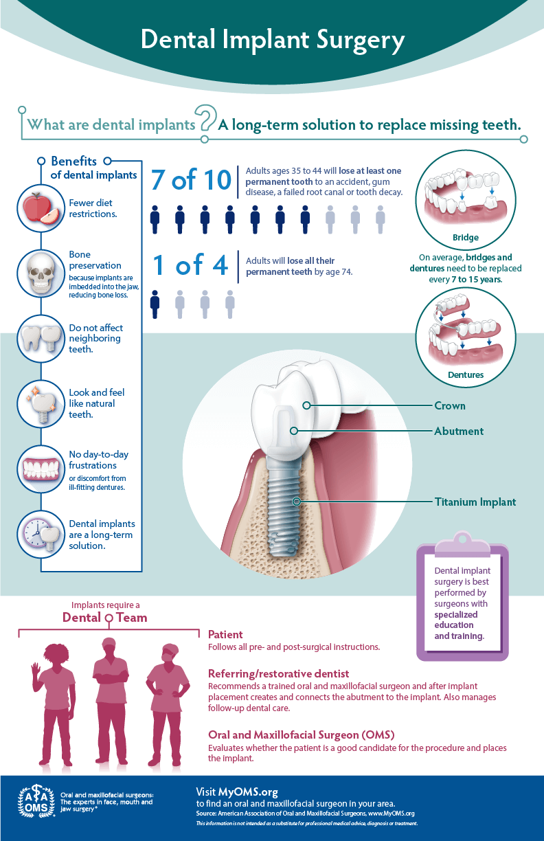 Infographic explaining Dental Implant surgery, including illustrations of .implant, including crown, abutment, and titanium implant; illustration of dental bridge fitting over existing teeth, and illustration of dentures fitting over gums. Full text provided, below.