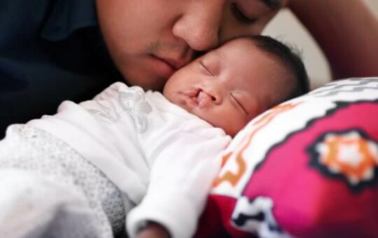 Photo of a young father bonding with his baby girl who has a cleft palate