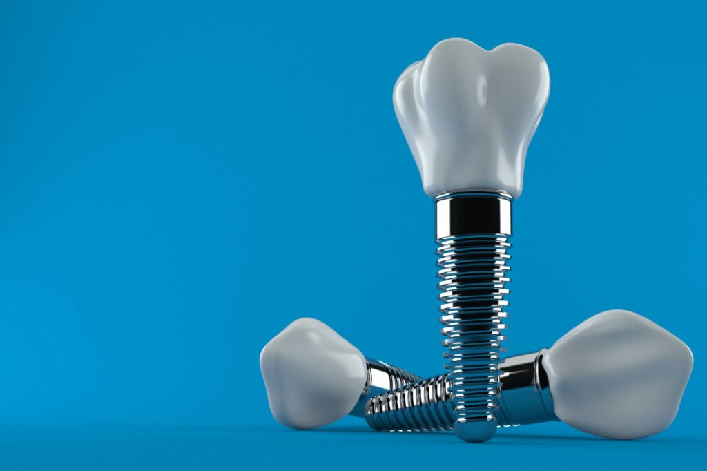 The Benefits of Dental Implants