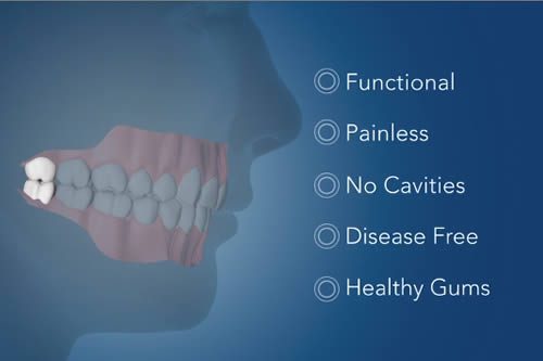 Wisdom Teeth Management