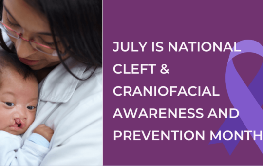 Photo of medical worker holding baby with cleft palate. Text reads July is National Cleft & Craniofacial Awareness and Prevention Month