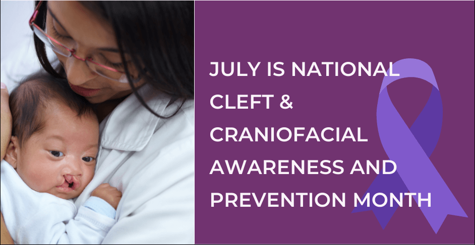 Photo of medical worker holding baby with cleft palate. Text reads July is National Cleft & Craniofacial Awareness and Prevention Month